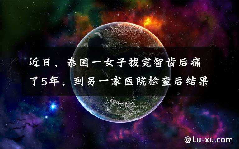 近日，泰國一女子拔完智齒后痛了5年，到另一家醫(yī)院檢查后結(jié)果讓網(wǎng)友不淡定了......