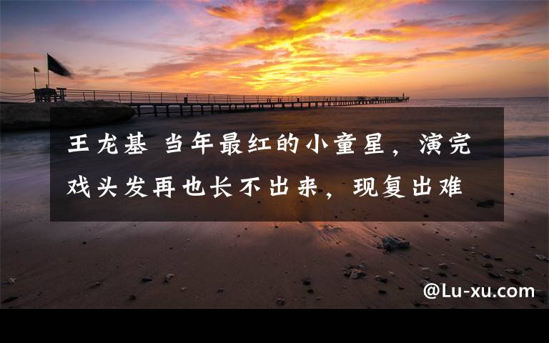 王龍基 當(dāng)年最紅的小童星，演完戲頭發(fā)再也長(zhǎng)不出來(lái)，現(xiàn)復(fù)出難演主角