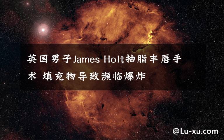 英國男子James Holt抽脂豐唇手術(shù) 填充物導(dǎo)致瀕臨爆炸