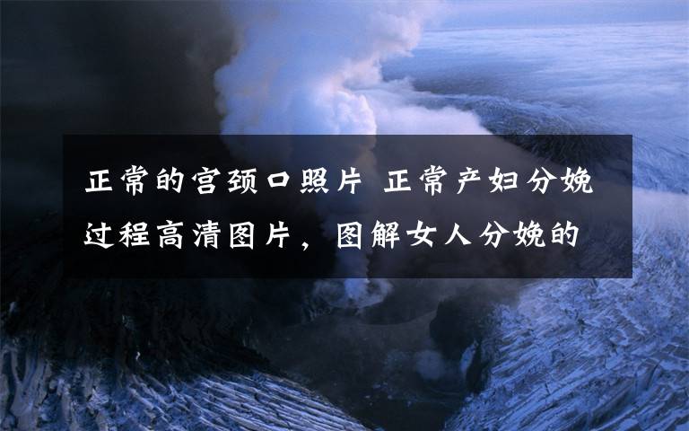 正常的宮頸口照片 正常產婦分娩過程高清圖片，圖解女人分娩的一些主要姿勢