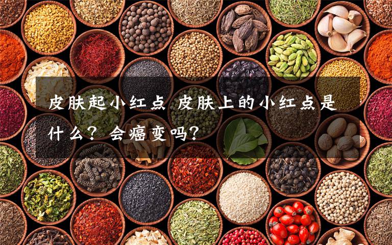 皮膚起小紅點(diǎn) 皮膚上的小紅點(diǎn)是什么？會(huì)癌變嗎？