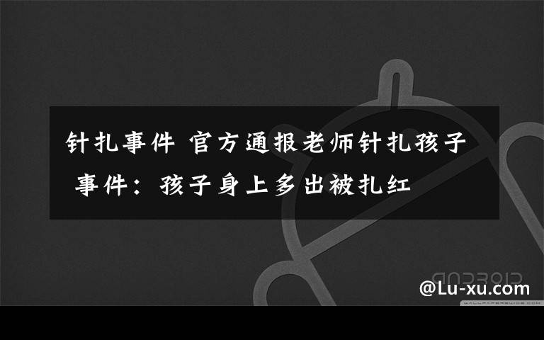 針扎事件 官方通報(bào)老師針扎孩子 事件：孩子身上多出被扎紅