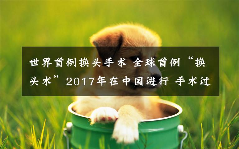 世界首例換頭手術 全球首例“換頭術”2017年在中國進行 手術過程非常復雜