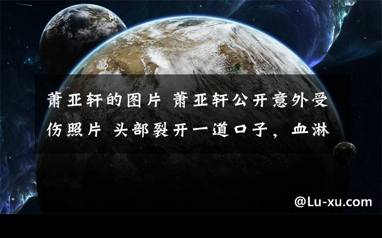 蕭亞軒的圖片 蕭亞軒公開意外受傷照片 頭部裂開一道口子，血淋淋的畫面讓人觸目驚心