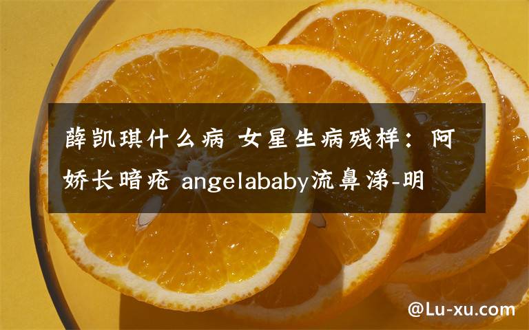 薛凱琪什么病 女星生病殘樣：阿嬌長暗瘡 angelababy流鼻涕-明星囧圖- 東南網