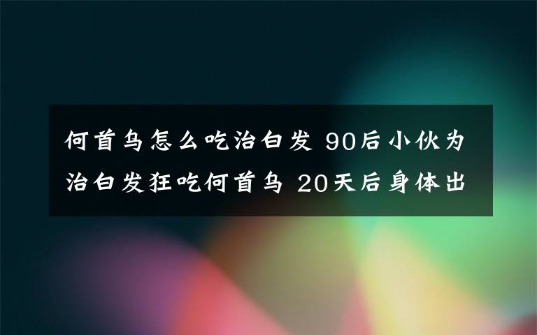 何首烏怎么吃治白發(fā) 90后小伙為治白發(fā)狂吃何首烏 20天后身體出現(xiàn)奇怪變化