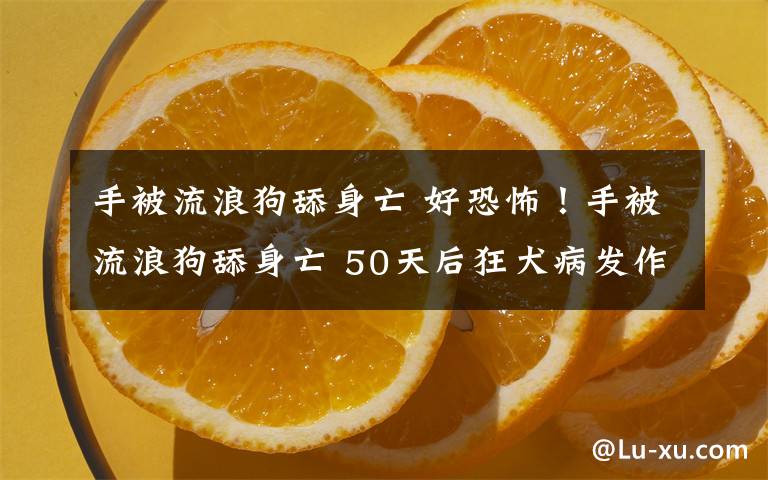 手被流浪狗舔身亡 好恐怖！手被流浪狗舔身亡 50天后狂犬病發(fā)作