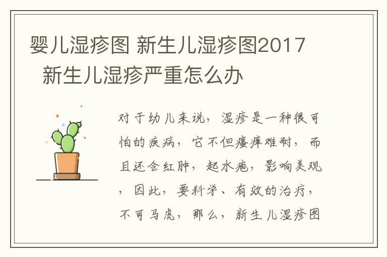 嬰兒濕疹圖 新生兒濕疹圖2017 新生兒濕疹嚴(yán)重怎么辦