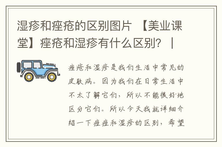 濕疹和痤瘡的區(qū)別圖片 【美業(yè)課堂】痤瘡和濕疹有什么區(qū)別？ | 手把手