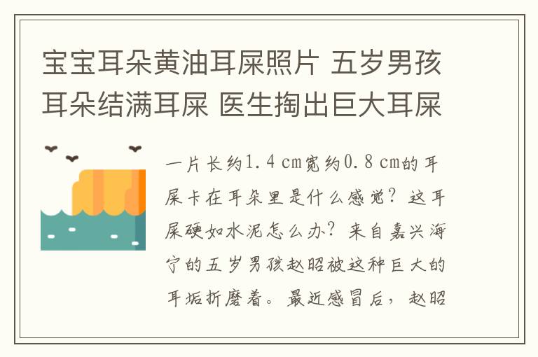 寶寶耳朵黃油耳屎照片 五歲男孩耳朵結(jié)滿耳屎 醫(yī)生掏出巨大耳屎