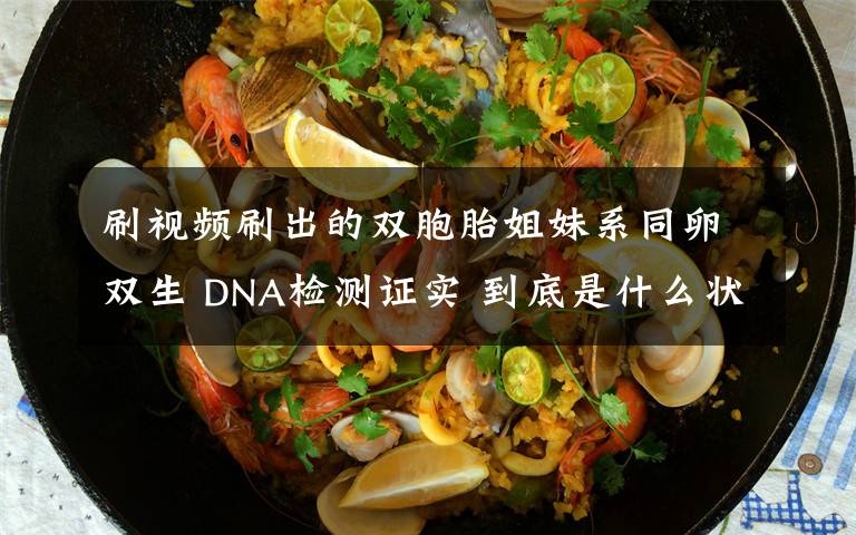 刷視頻刷出的雙胞胎姐妹系同卵雙生 DNA檢測證實 到底是什么狀況？