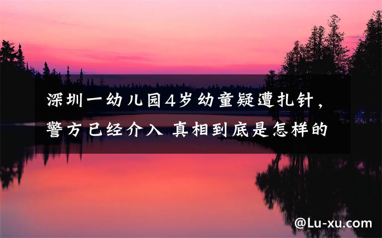 深圳一幼兒園4歲幼童疑遭扎針，警方已經(jīng)介入 真相到底是怎樣的？