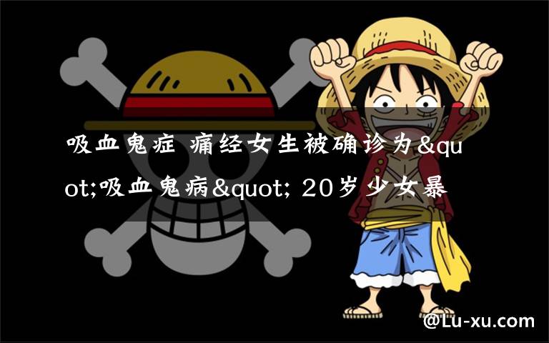 吸血鬼癥 痛經(jīng)女生被確診為"吸血鬼病" 20歲少女暴露在陽光下皮膚起水泡