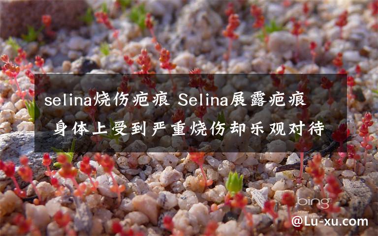 selina燒傷疤痕 Selina展露疤痕 身體上受到嚴(yán)重?zé)齻麉s樂觀對(duì)待