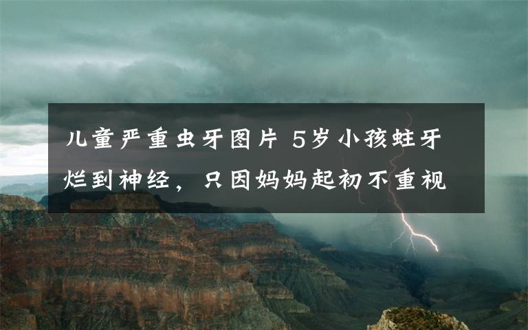 兒童嚴重蟲牙圖片 5歲小孩蛀牙爛到神經(jīng)，只因媽媽起初不重視