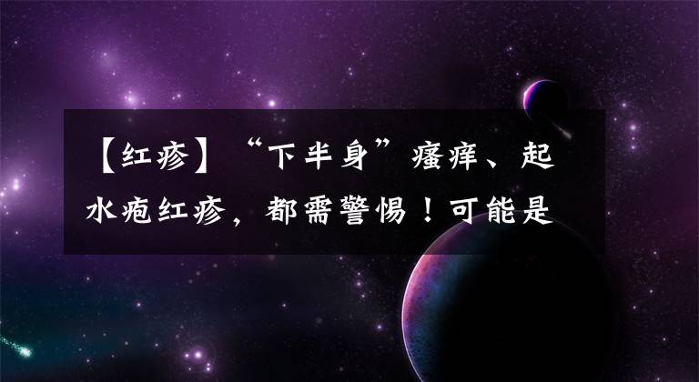 【紅疹】“下半身”瘙癢、起水皰紅疹，都需警惕！可能是這5種性傳播疾病