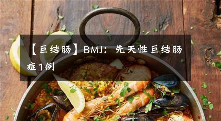 【巨結(jié)腸】BMJ：先天性巨結(jié)腸癥1例