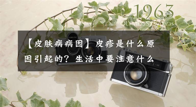 【皮膚病病因】皮疹是什么原因引起的？生活中要注意什么？