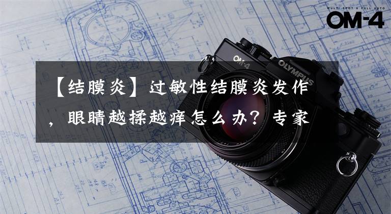 【結(jié)膜炎】過敏性結(jié)膜炎發(fā)作，眼睛越揉越癢怎么辦？專家教你一招止癢