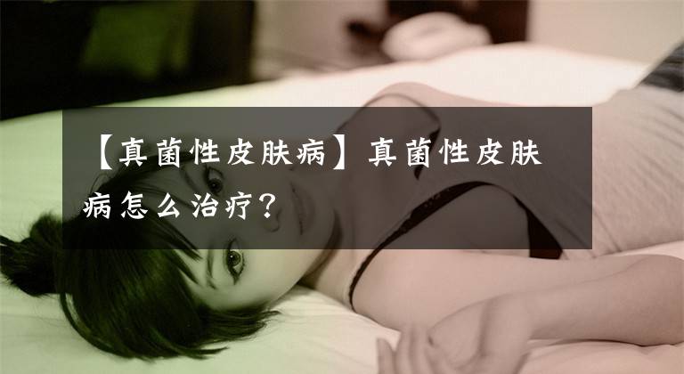 【真菌性皮膚病】真菌性皮膚病怎么治療？