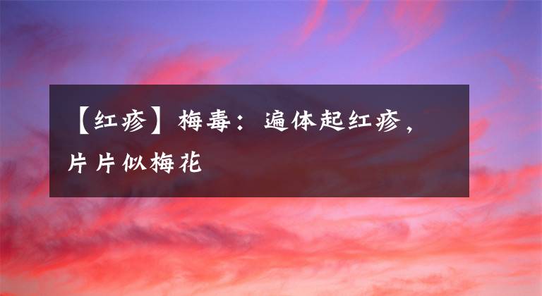 【紅疹】梅毒：遍體起紅疹，片片似梅花