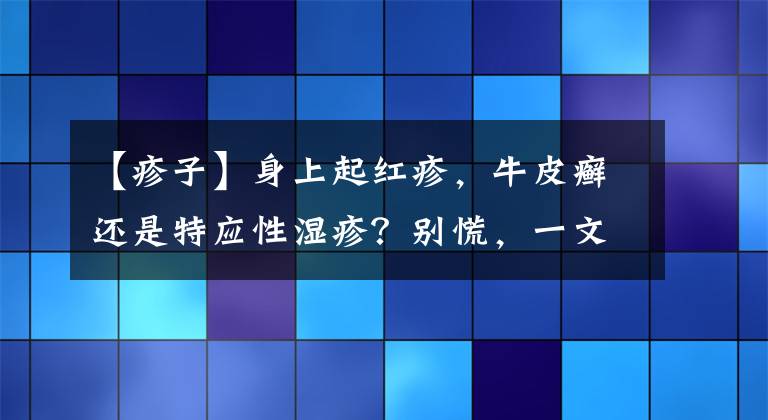 【疹子】身上起紅疹，牛皮癬還是特應(yīng)性濕疹？別慌，一文幫你分清