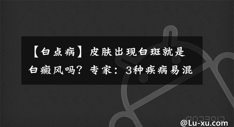 【白點病】皮膚出現(xiàn)白斑就是白癜風(fēng)嗎？專家：3種疾病易混淆