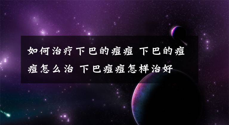 如何治療下巴的痘痘 下巴的痘痘怎么治 下巴痘痘怎樣治好