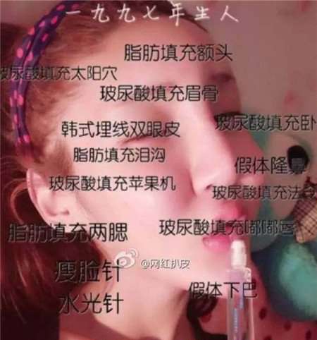 桃花寶寶李美人的資料 桃花寶寶是男的女的 桃花寶寶整容對比