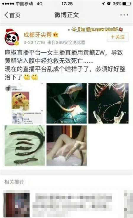 男人都是鱔變的 男人都是鱔變的圖片 為什么說(shuō)男人都是鱔變的