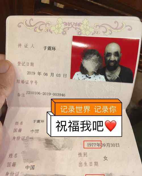 中國第一毛孩 中國第一毛孩結(jié)婚了怎么回事？中國第一毛孩于震寰結(jié)婚照片曝光