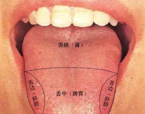 舌苔圖片看病圖解 舌診的學(xué)問，通過舌頭看病，附帶治療方法