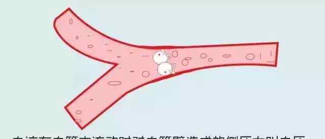 什么叫血壓高?有幾個(gè)不清楚