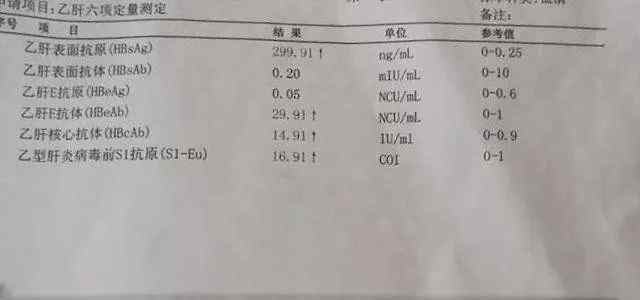 乙肝五項(xiàng)查驗(yàn)結(jié)果分析,假如乙肝病毒核心抗體