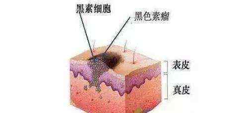 甲黑線 黑色變的甲黑線到底是怎么回事？