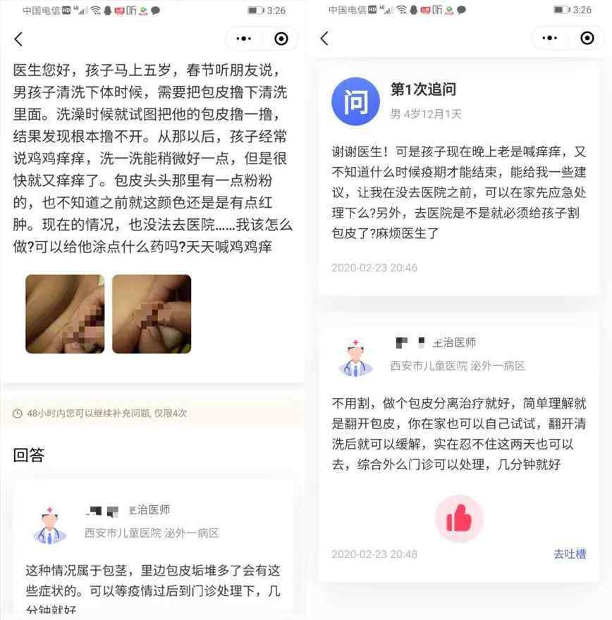 五歲兒子是相公 為了翻開5歲兒子的包皮，我們?nèi)引R上陣