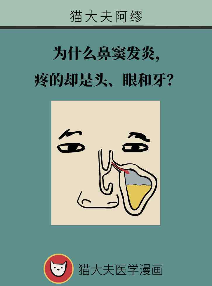 鼻竇炎牙酸 為什么鼻竇發(fā)炎， 疼的卻是頭、眼和牙？