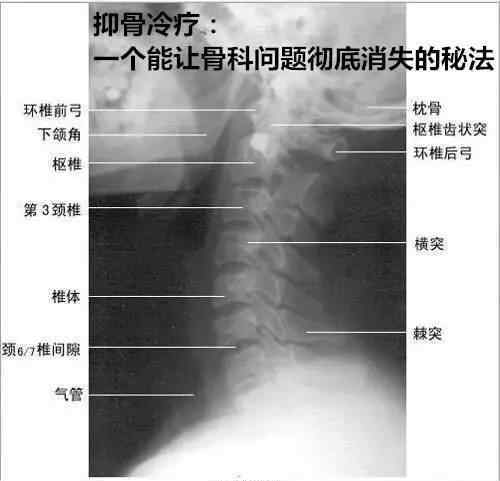 頸椎骨退行性病變的具體表有哪些方面?