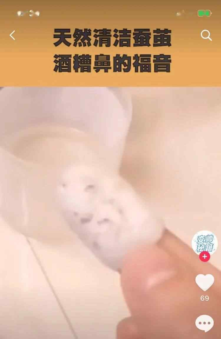 杭州市女孩刷短視頻被種草“蠶繭祛黑頭”,取得手發(fā)覺不但惡心想