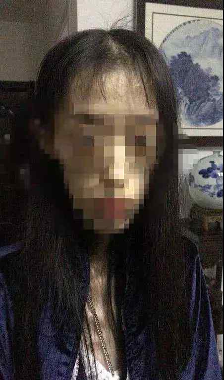 張錦明 要瘦不要命？女孩減肥剩50斤 她骨瘦如柴的樣子太恐怖