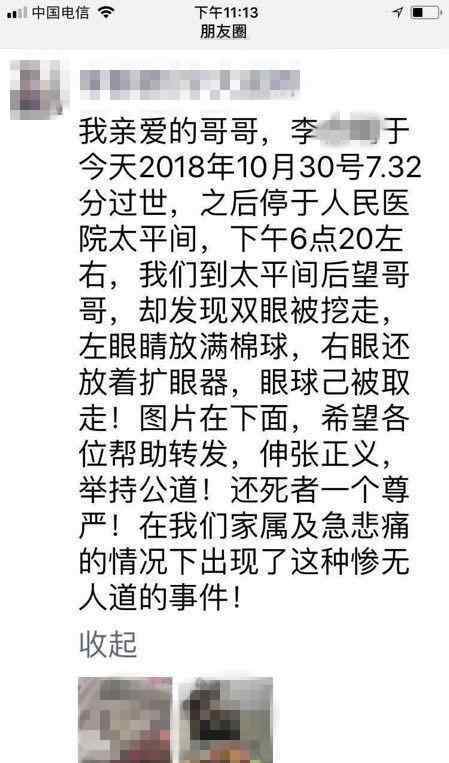 太平間雙眼被挖 左眼框塞滿棉球！太平間雙眼被挖 究竟是誰對死者如此的殘忍？