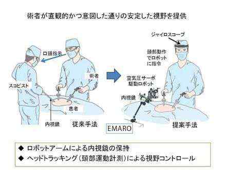 伊索機械表 關于那些被熱議的手術機器人 我們都知道些什么