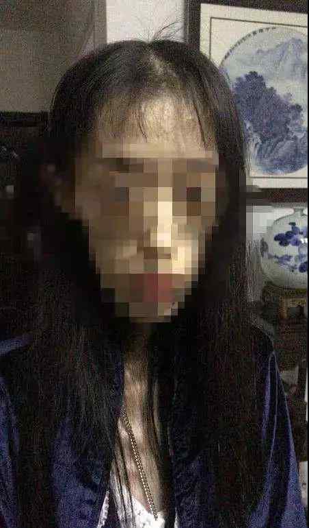 骨瘦如柴的女人 要瘦不要命？女孩減肥剩50斤 她骨瘦如柴的樣子太恐怖