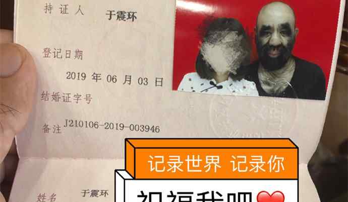 震寰 中國第一毛孩結(jié)婚了 于震寰個(gè)人資料起底老婆高顏值引熱議