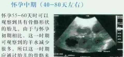 懷孕40天b超圖片 懷孕母豬20天到90天的B超圖像，你會(huì)看嗎？