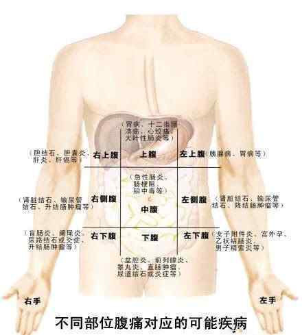 肚子疼的圖片 看懂一張圖 讓你懂得肚子疼對(duì)應(yīng)的各種疾病