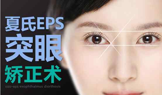 眼球突出治療 夏氏EPS突眼矯正術(shù)——突眼癥患者的福音