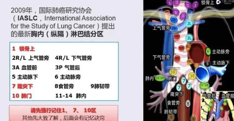 肺ct 如何優(yōu)雅的解讀肺部 CT ?