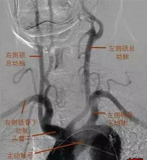 王小國