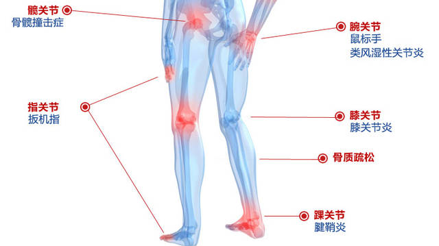 骨性關(guān)節(jié)炎如何治療 多種有效的治療方法